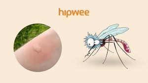 Letaknya juga lebih tersebar secara acak di perut, punggung, dan yang lainnya. 11 Tipe Bekas Gigitan Serangga Yang Ada Di Sekitar Kita Biar Lebih Waspada Akan Bahayanya