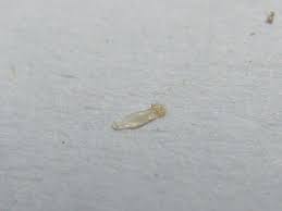 Instead, the presence of a white bulb on the strand can indicate a simple case of telogen phase shedding, or the onset of telogen effluvium as caused by physical and emotional stressors. Pin On Dermatillomania