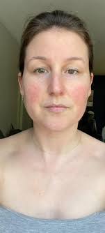 ✨ Transform your hair with Ybera! ✨ Get 20% OFF all Ybera products today.  Use code YBERA20 at checkout. 💆‍♀️💖 🛒 Don't wait—your dream hair starts  now!👇