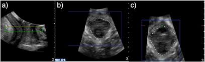 Details of applicable surcharges can be found on our to be eligible for funded pregnancy scans, you must be a new zealand resident and you must have a valid referral form from a midwife, doctor, or specialist. Pregnancy Ultrasound Auckland Cost