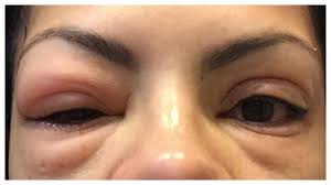 How To Remove False Eyelash Extensions At Home False Eyelash Extensions False Eyelashes Tutorials Eyelashes Tutorial