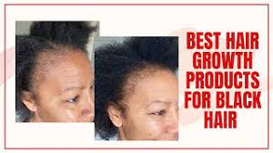 However, there are very few products that will make your hair grow faster than your optimal rate — which varies from person to person. Best Hair Growth Products For Black Women Over 40 Update Time With Natalie Youtube