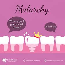 Brash Dental Implants Before And After Porcelain Veneers Teethwhiteningstrips Toothimplant Dental Tourism Dental Dental Implants Cost