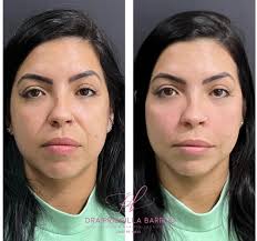 Dra Priscilla Barros