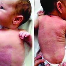 Image result for Harlequin Color Change