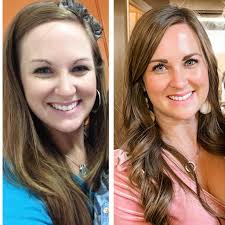 Hello everyone! I've recently completed my 500-hour certification in  Orthomolecular Naturopathy and am excited to introduce my new wellness  services. Many of the skin concerns you might consider purely cosmetic are  actually