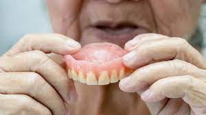 Tipos de prótesis dentales, todo lo que necesitas saber