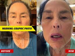 Duck Dynasty' Star Kay Robertson Healing Nicely After Dog Bite