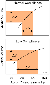 Image result for Pulse Pressure