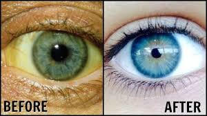 Get Whiter Eye Whites With These 7 Exclusive Tips Vision Eye Whiten Eyes Eye Sight Improvement