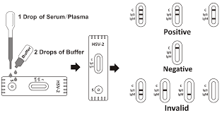 When his test result came back they were very confusing. Hsv Test Hsv Infection Hsv 1 2 Igg Hsv 1 2 Igm Hsv 1 2 Ab Rapid Test Rapid Test Manufacturer