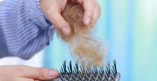 Hair loss is preventable and reversible. Telogen Effluvium Symptoms Treatment And Recovery