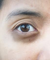 Inilah pilihan eye cream terbaik! Cara Menghilangkan Lingkaran Hitam Di Mata Dark Circle Eye