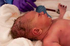 Newborn Baby Head Shape Cone Newborn Baby