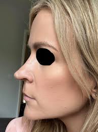 Hi guys is there a WhatsApp link that works for a group for Dr Cagatay  Ruhi. Thank you.