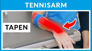Stellen sie sich ihr individuelles tennisarm workout tipp: Tennisellenbogen Tennisarm Behandeln Ubungen Teil 1 Youtube