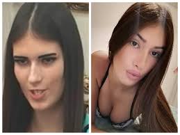 EVO ŠTA MOŽETE DOBITI ZA 100, A ŠTA ZA 450 EVRA! Sandra Meduza se  izoperisala DO NEPREPOZNATLJIVOSTI, a njen CENOVNIK za prodaju intime ŠOKIRA