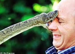 Image result for Snake Bite