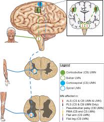 Amyotrophic lateral sclerosis (als), or lou gehrig's disease, is a fatal degenerative neurological condition that causes progressive weakening. The Role Of Upper And Lower Motor Neurons In Different Als Variants Download Scientific Diagram
