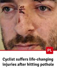 I am so angry with what happened, that pothole shouldn't have been there'