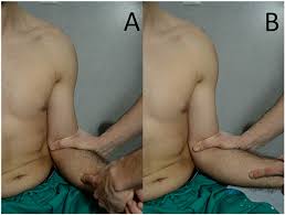 Image result for Shoulder Instability Exam