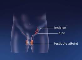 We did not find results for: Cancer Des Testicules Centre Urologie Colmar