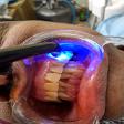 tooth restorations product image
