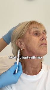 Treat a client with me......