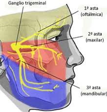 Que Es La Neuralgia Del Trigemino Diagnostico Y Tratamiento