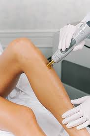 We specialise in laser hair removal, acne and scar treatment, prp therapy, skin lightening and body contouring services. All You Need To Know About Laser Hair Removal Shaadiwish