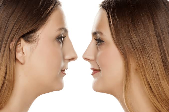 How Many Hours Does a Rhinoplasty Take? – Murphy Plastic Surgery