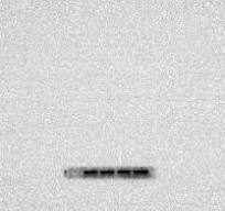 20- Deoxyingenol attenuate morphine-induced hippocampus ...