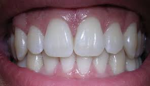 Image result for pictures of gopal tooth powder