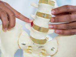 Radiculopathy Causes Symptoms And Treatment