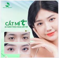 Mí mắt đẹp sang