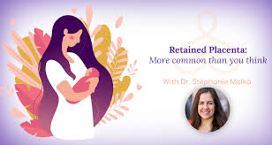 Image result for Retained Placenta