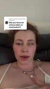 Danielle Eye Removal