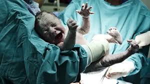 The effect of childbirth no-one talks about