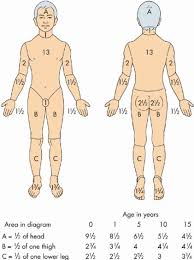 chart for calculation of percentage of bsa burn in children