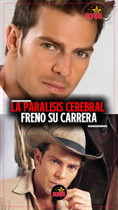El actor venezolano, Juan Alfonso Batista, El Gato, confesó cómo ha vivido  desde los 19 años de edad, con la parálisis facial. #esreviral