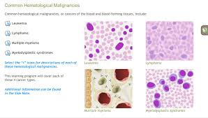 Image result for Hematologic Cancer