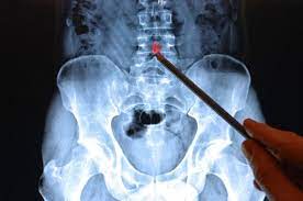We are an accredited health provider so you can claim our fees from your private health insurance. Do I Really Need An X Ray Or Mri For Lower Back Pain