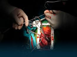 While training young surgeons each day, i tell them taking up pediatric cardiac surgery is like. Best Cardiac Surgery Cardio Thoracic Vascular Surgery Hospital In India Top Heart Surgery Treatment Hospital Fortis Healthcare