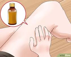 Minyak kelapa ternyata salah satu cara menghilangkan uban yang ampuh yaitu dengan cara dicampurkan dengan air jeruk nipis. Cara Menghilangkan Kurap Obat Alami Apa Yang Bisa Membantu