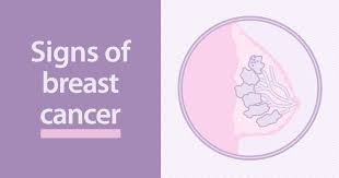 Breast cancer treatment can be highly effective, especially when the disease is identified early. What Are The Signs Of Breast Cancer Ctca