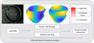 Join to listen to great radio shows, dj mix sets and podcasts. Substrate Spatial Complexity Analysis For The Prediction Of Ventricular Arrhythmias In Patients With Ischemic Cardiomyopathy Circulation Arrhythmia And Electrophysiology