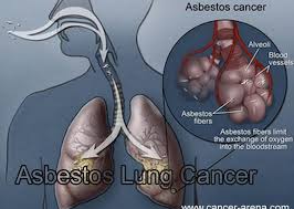 Pin Di Lung Cancer