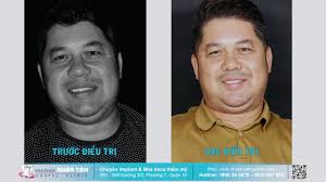 KH NGUYỄN THANH CƯỜNG: “TẤT CẢ MỌI NGƯỜI Ở ĐÂY ĐỀU RẤT CHUYÊN NGHIỆP”