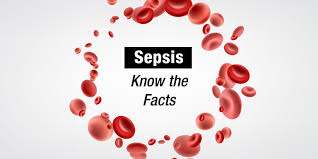 Image result for Sepsis