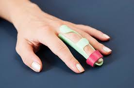 Schienenversorgung Ergotherapie Und Handtherapie Koln